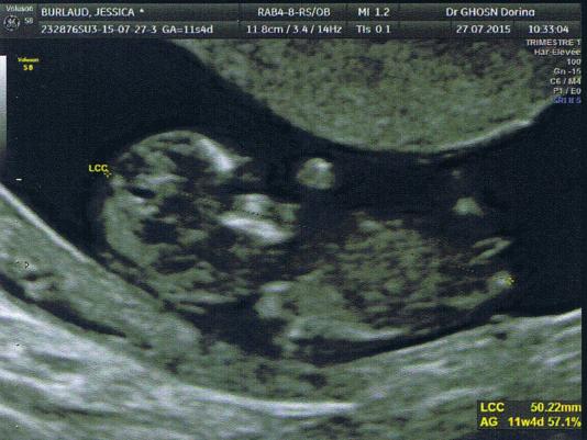 Jessica-BURLAUD-enceinte